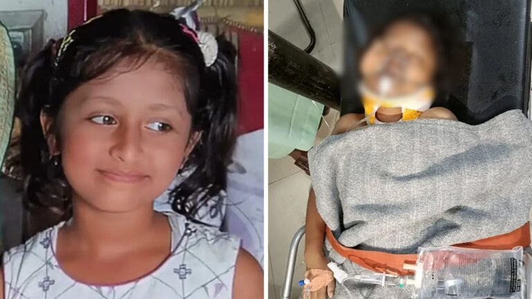 লাইফ সাপোর্টে টেকনাফে গুলিবিদ্ধ শিশু হুজাইফা, চিকিৎসক যা জানালেন